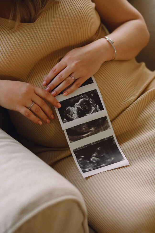 Close-up of pregnant belly and sonogram photo in hands of mother. Concept of pregnancy, gynecology, medical test, maternal health